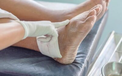 هل الغرغرينا تسبب الوفاه الحتمية؟