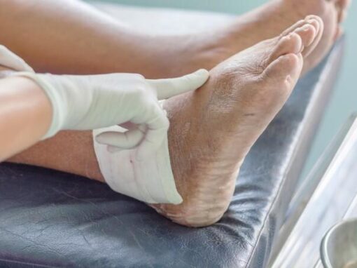 هل الغرغرينا تسبب الوفاه الحتمية؟